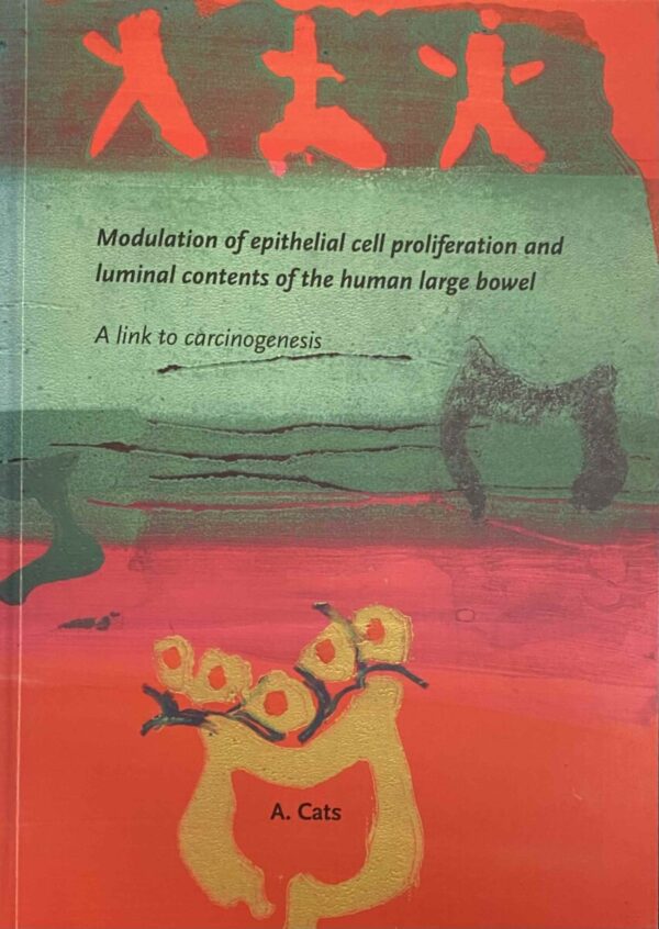 Modulation of epithelial cell proliferation and luminal contents of the human large bowel. A link to carcinogenesis